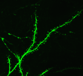 dendritic_spines
