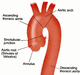 normal_aorta